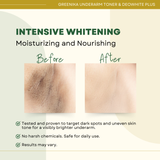 Greenika 60ML DeoWhite Plus + 50ML Underarm Toner Combo