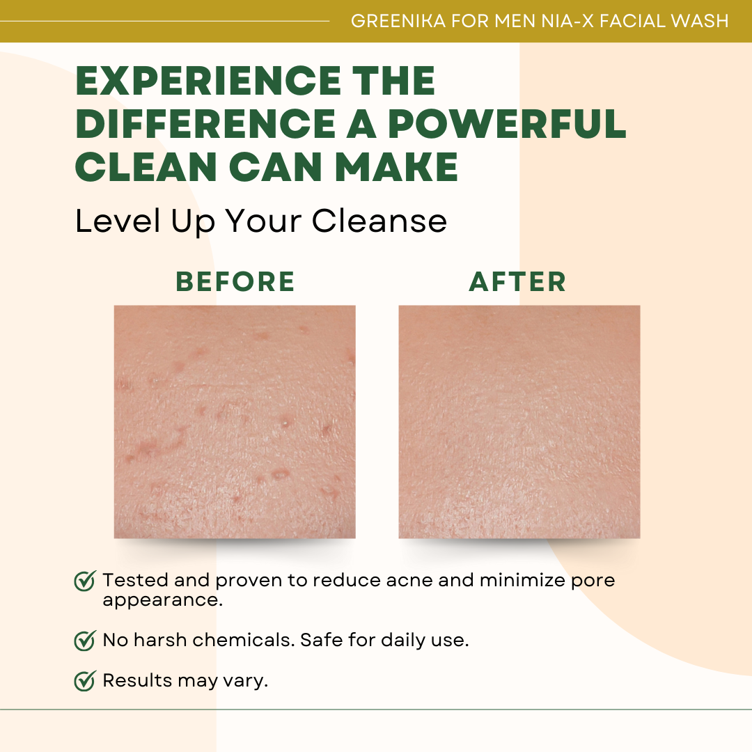 Greenika for Men Nia-X Facial Wash