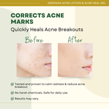 Greenika Acne Lotion + Acne Heal Gel Combo