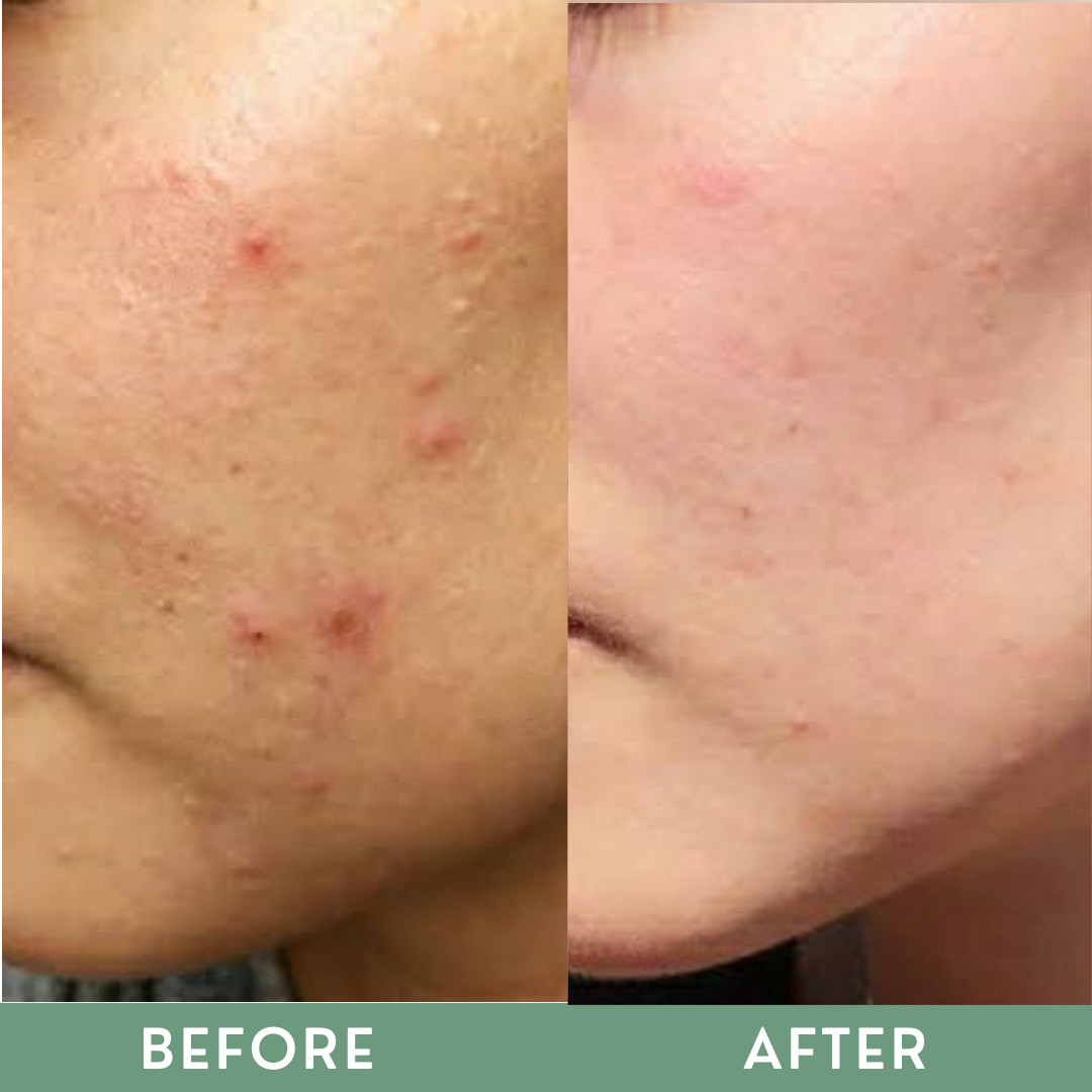 Greenika Cocobleach Serum