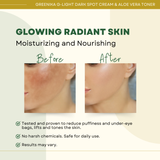 Greenika Aloe Vera Toner + G-Light Dark Spot Cream Combo
