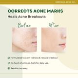 Greenika Acne Plus Gel