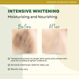 Greenika DeoBleach Underarm Whitening Gel