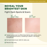 Greenika Kojic Acid Soap