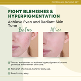 Greenika 3-in-1 Bleaching Set