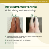 Greenika Melasma Peeling Soap