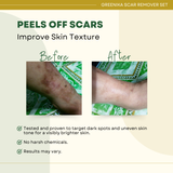 Greenika Scar Remover 4 PC Set