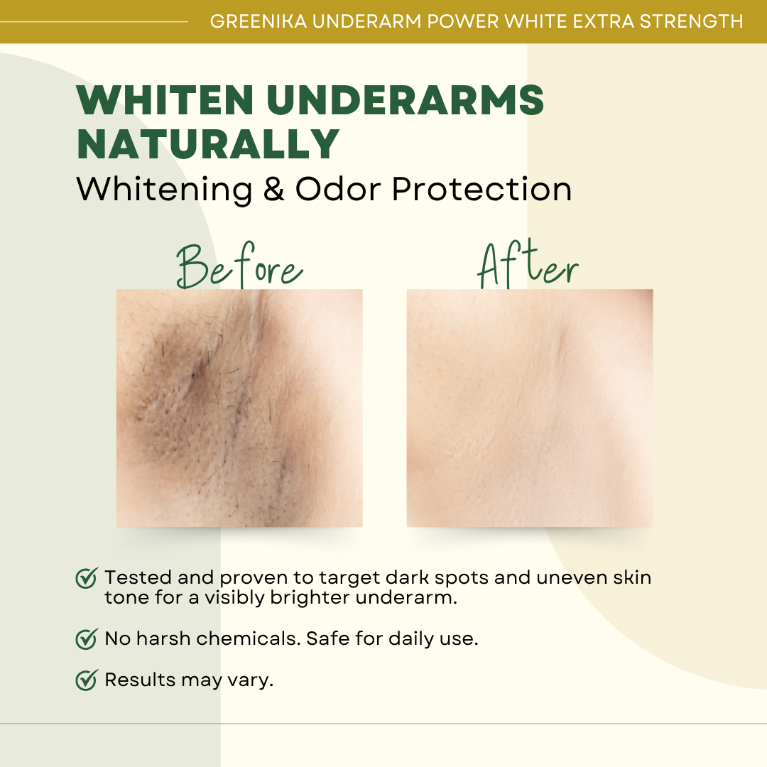 Greenika 7X Underarm Whitening Cream Extra Strength
