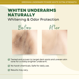 Greenika 7X Underarm Whitening Cream Extra Strength