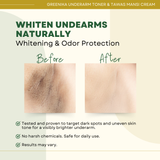 Greenika 50ML Underarm Toner + 30G TawasMansi Cream Combo