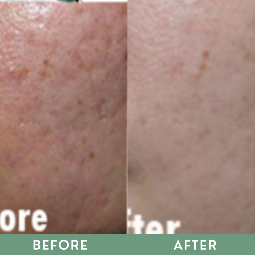 Greenika 100ML Retinol Facial Wash + 10G Retinol Cream