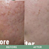 Greenika 100ML Retinol Facial Wash + 10G Retinol Cream