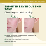 Greenika Acne Body Wash + Cell Renewal Cream Combo
