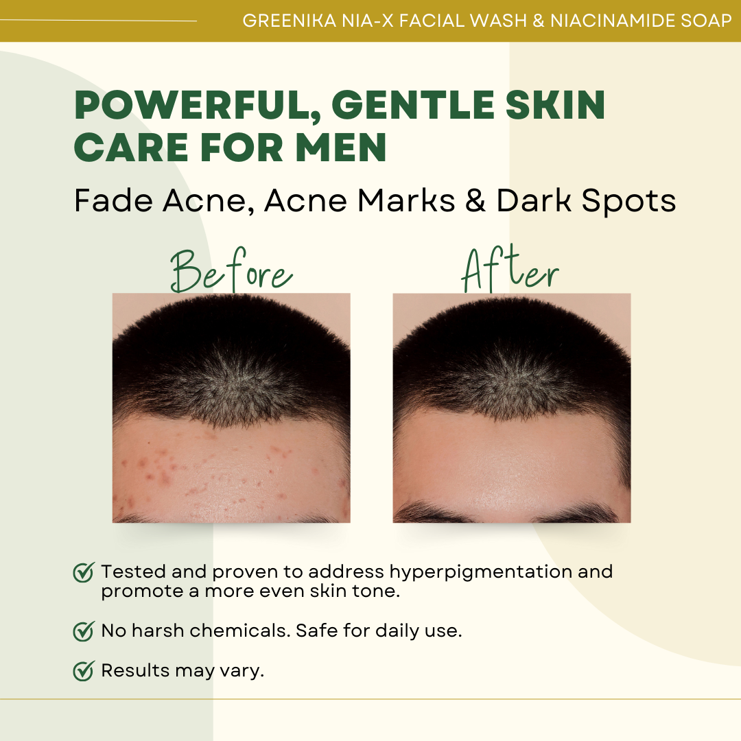 Greenika 100ML Nia-X Facial Wash for Men + Niacinamide Soap for Men Combo
