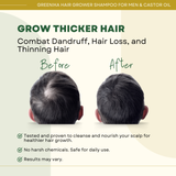 Greenika for Men 100ML Hair Grower Shampoo + 50ML Castor Oil Combo