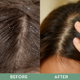 Greenika Anti-Dandruff Shampoo