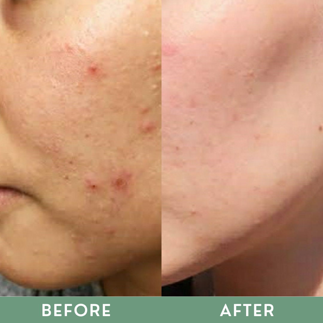 Greenika Retinol Soap
