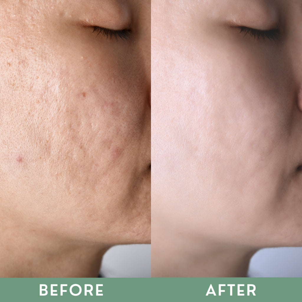 Greenika Retinol Face and Body Scrub
