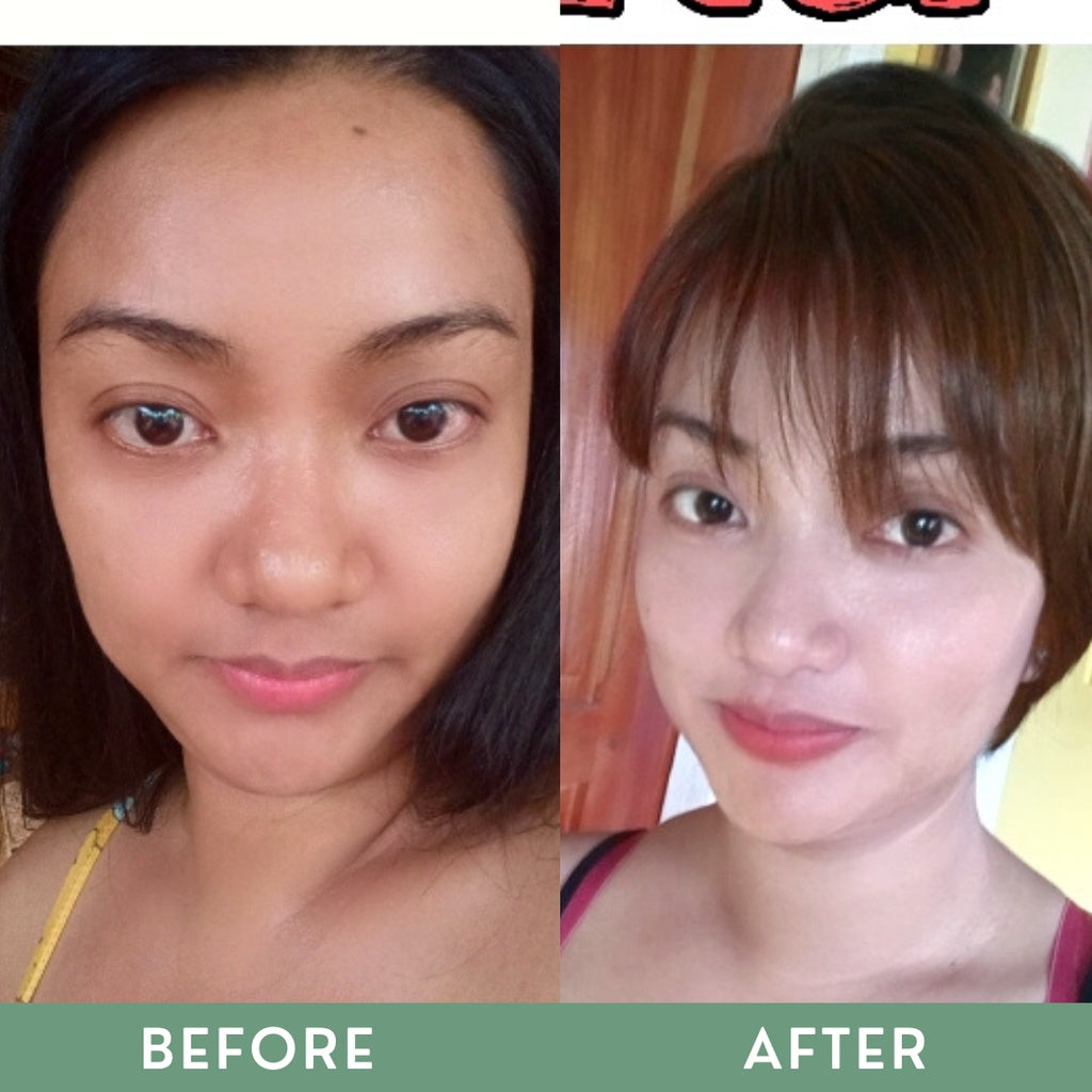Greenika Bleaching Soap & Bleaching Serum Duo
