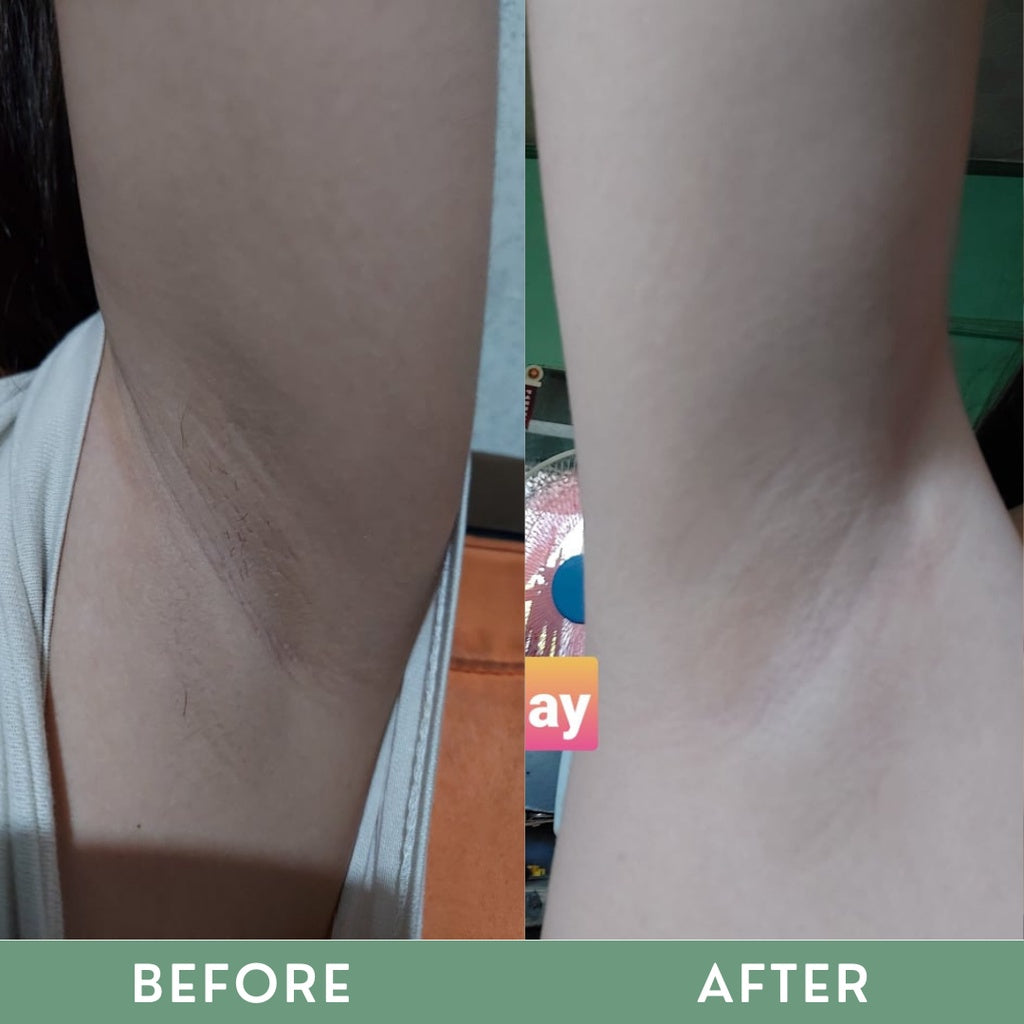 Greenika Underarm Cream & Underarm Serum Duo