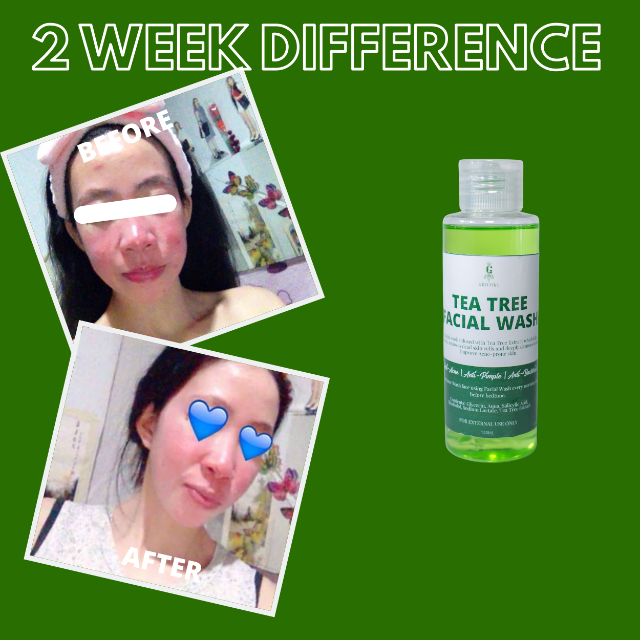 Greenika Tea Tree Anti Acne Facial Cleanser