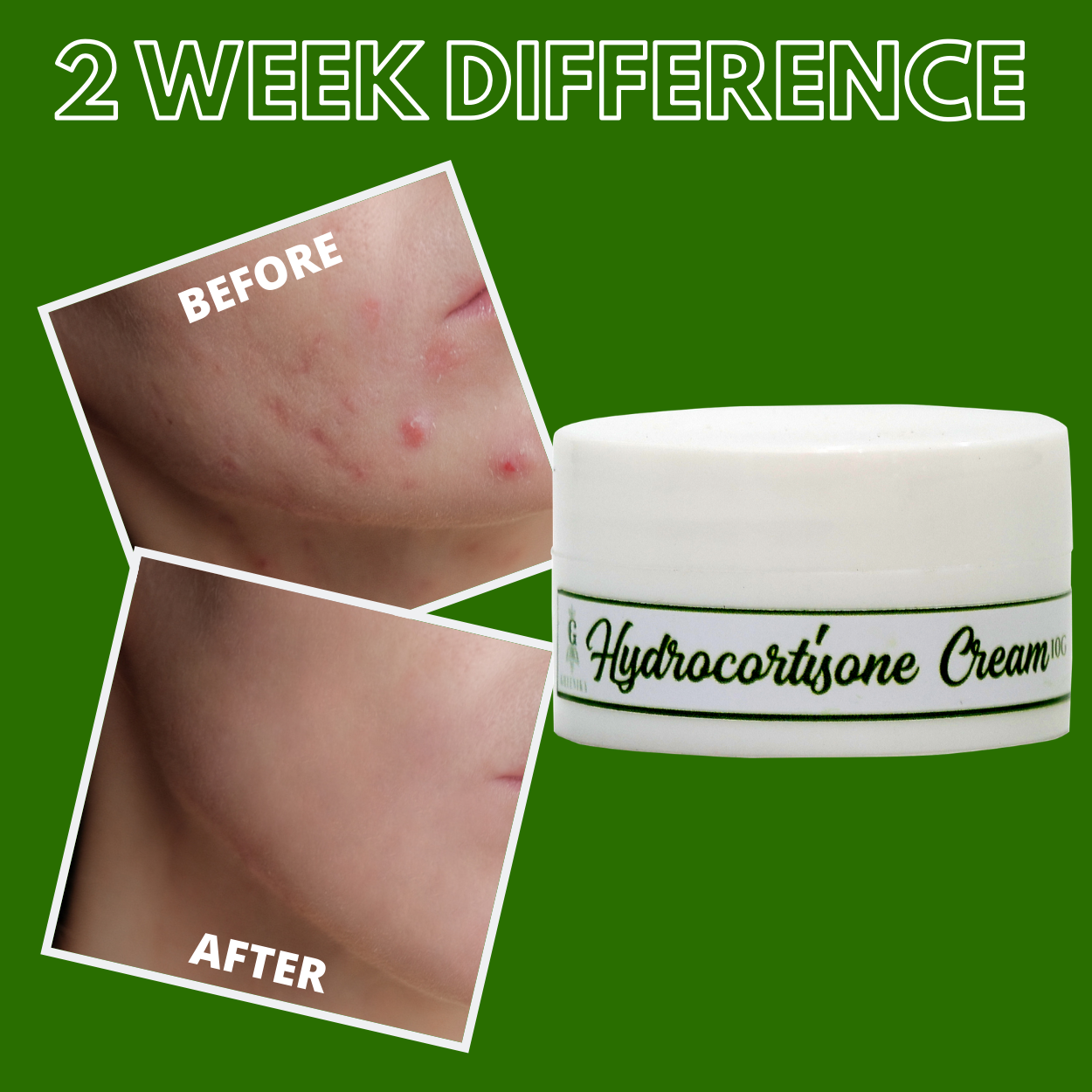 Greenika Hydrocortisone Cream