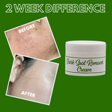 Greenika Dark Spot Remover Cream