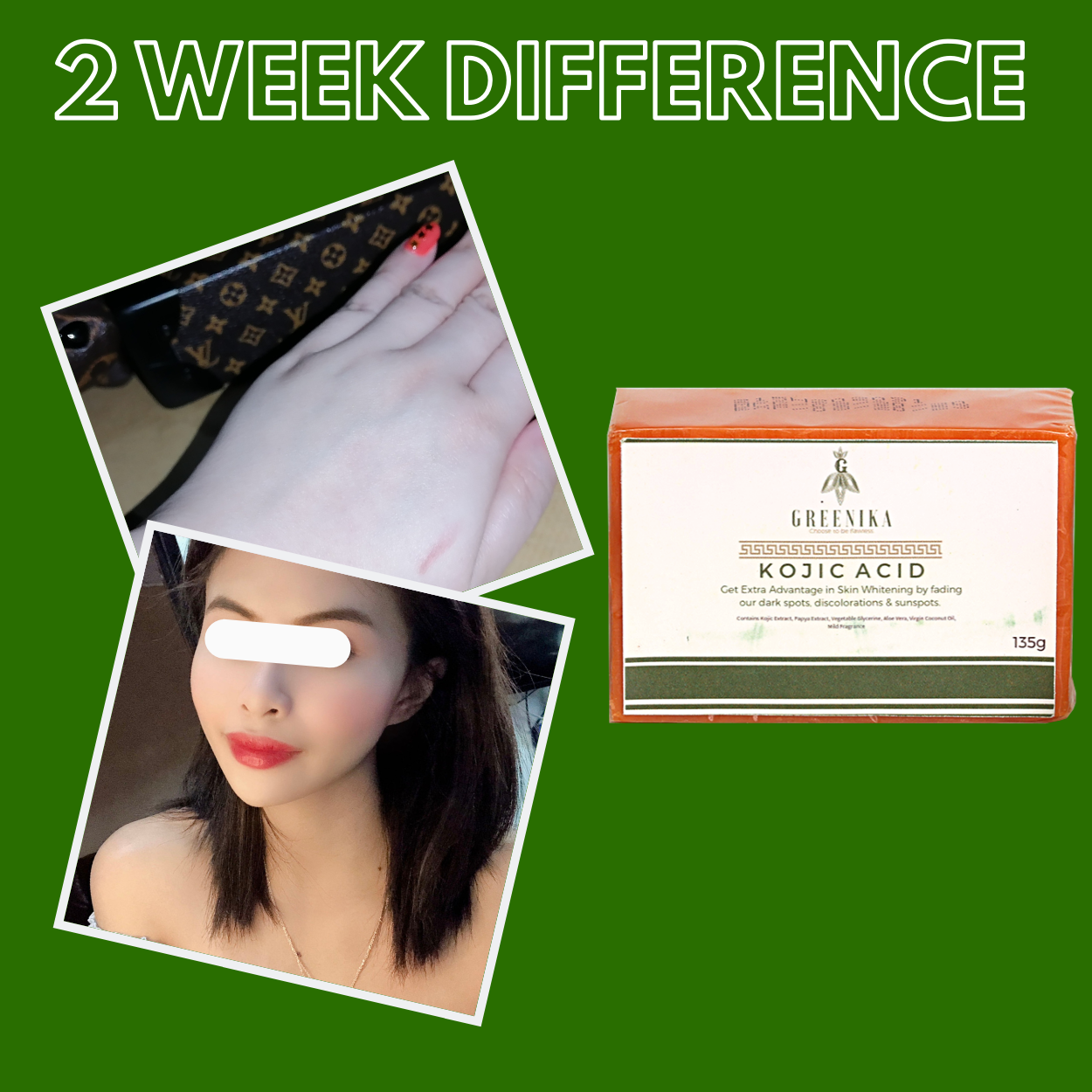 Greenika Kojic Acid Soap