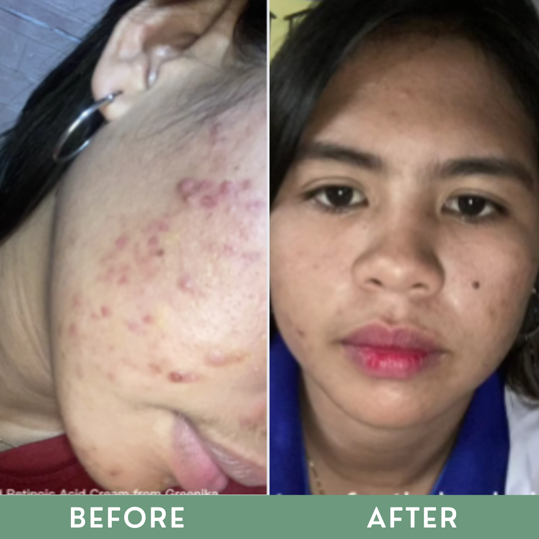 Greenika Retinol Toner