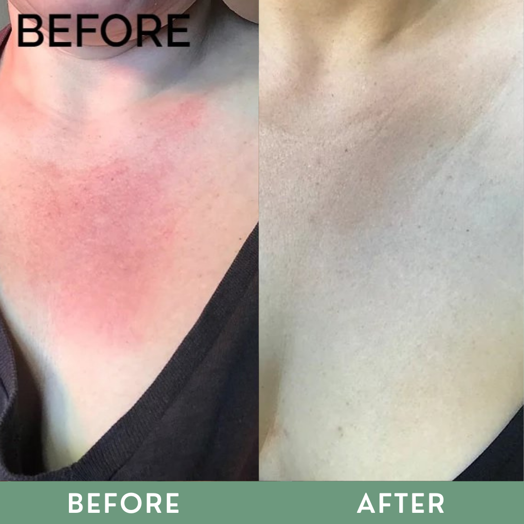Greenika Sun Protect Sun Block Lotion SPF70 Broad Spectrum
