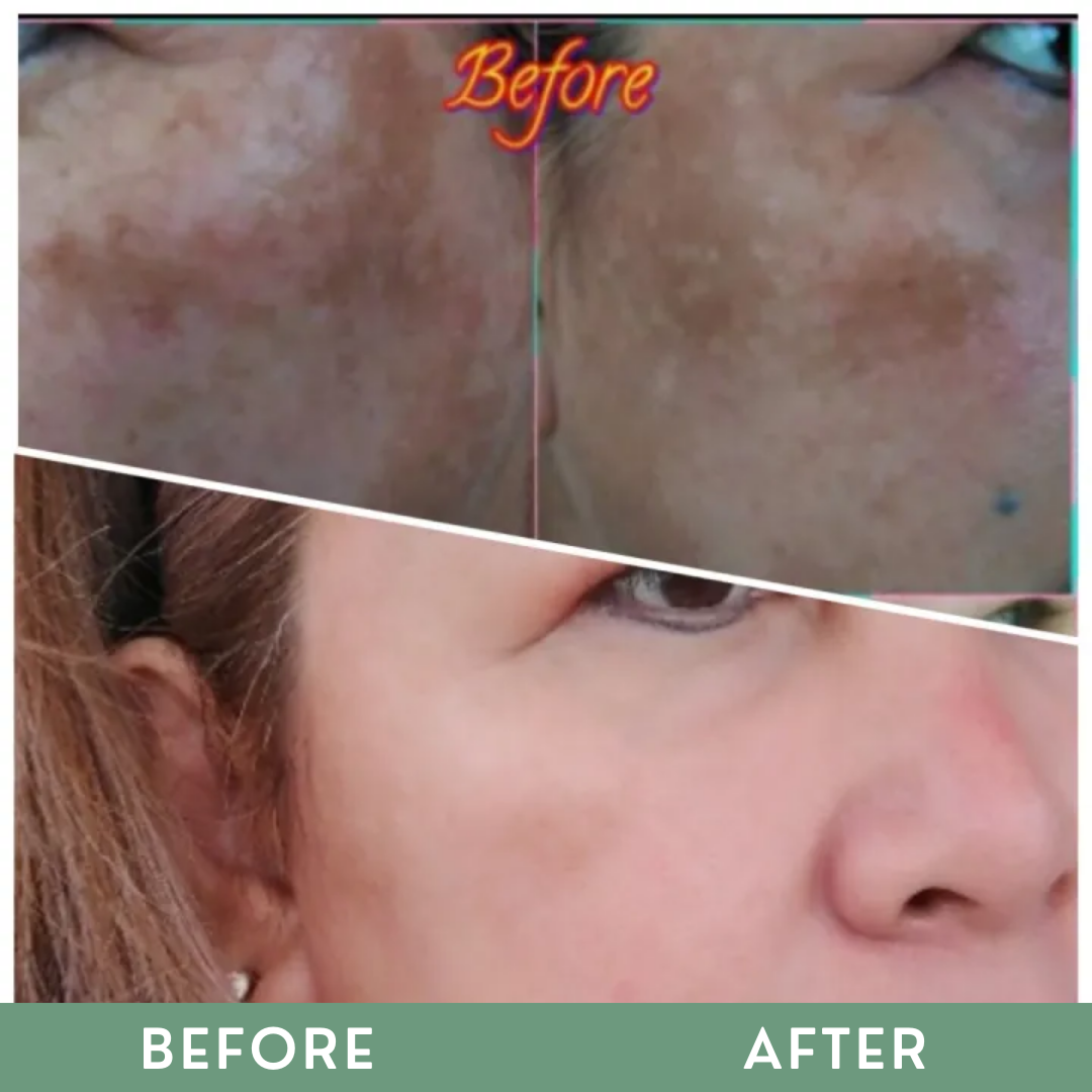 Greenika Remolded Kojic Acid Soap