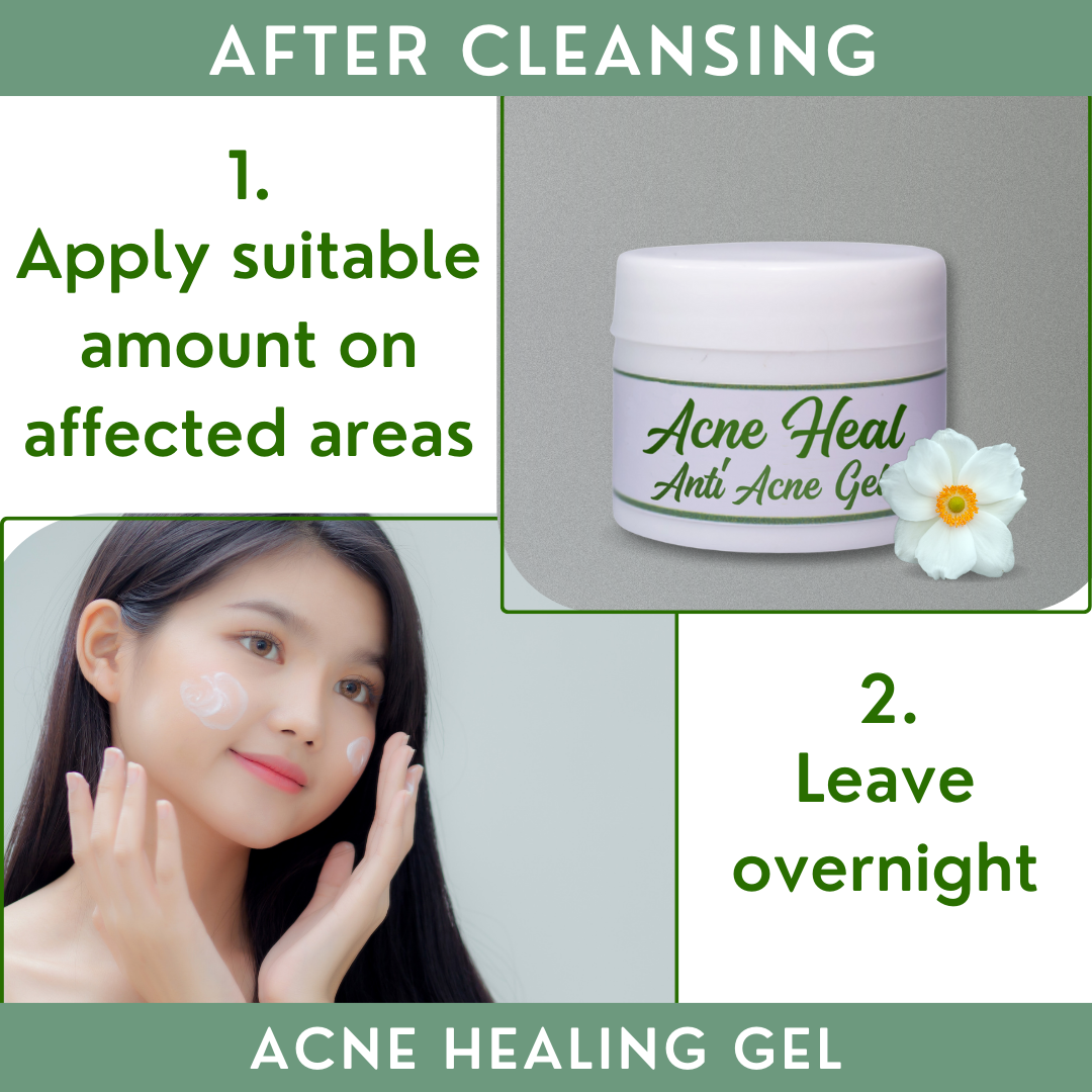 Greenika Acne Heal Gel