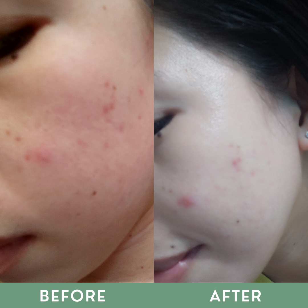 Greenika Organic Glycolic Soap
