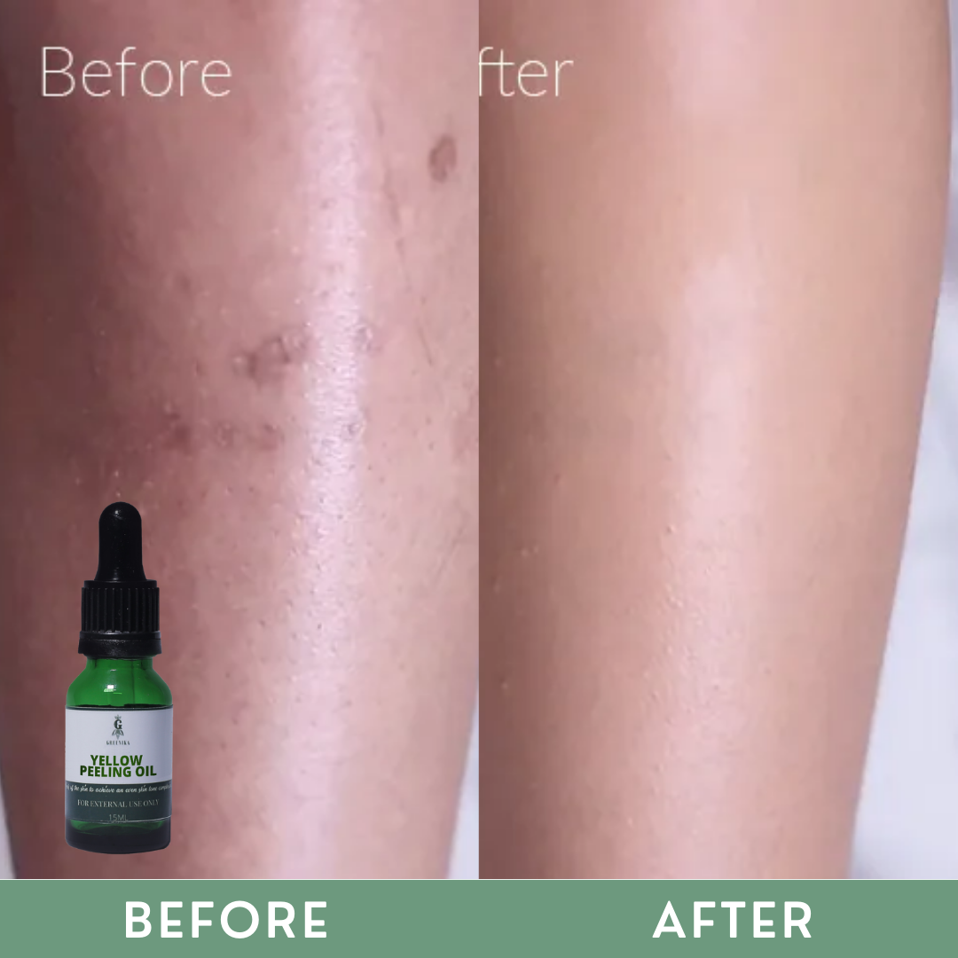 Greenika Yellow Extra Strong Peeling Oil