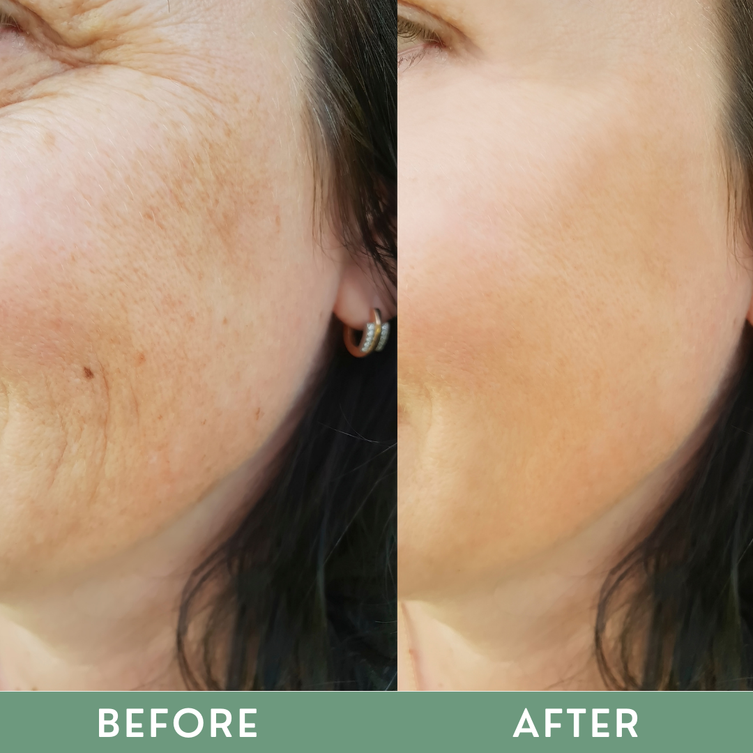 Greenika Aloe Vera with BHA Facial Serum