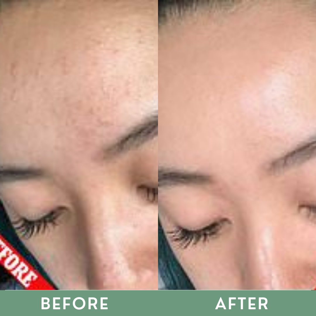 Greenika Micellar Water Cleansing Toner