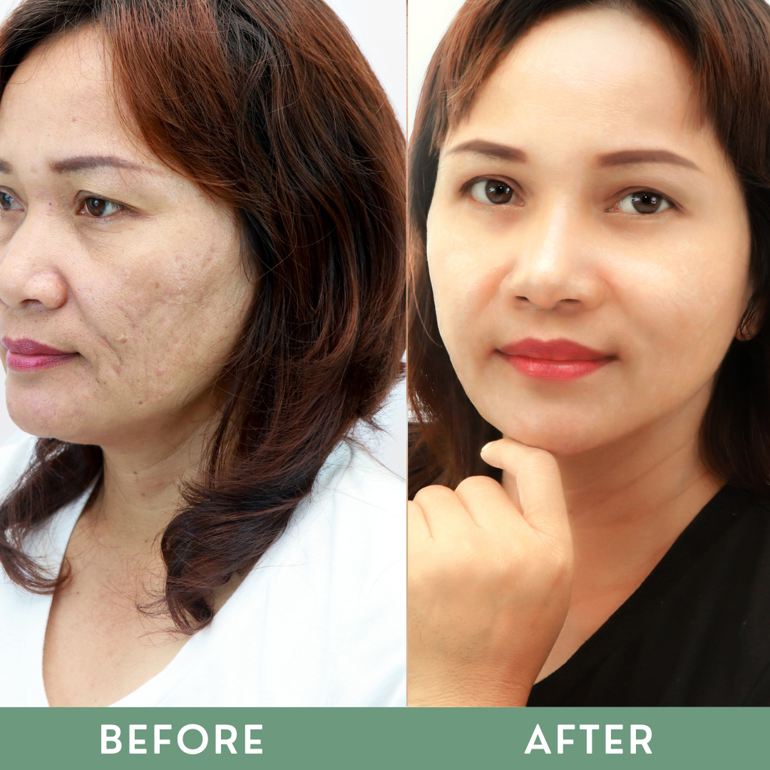 Greenika Vitamin E Anti Aging Serum