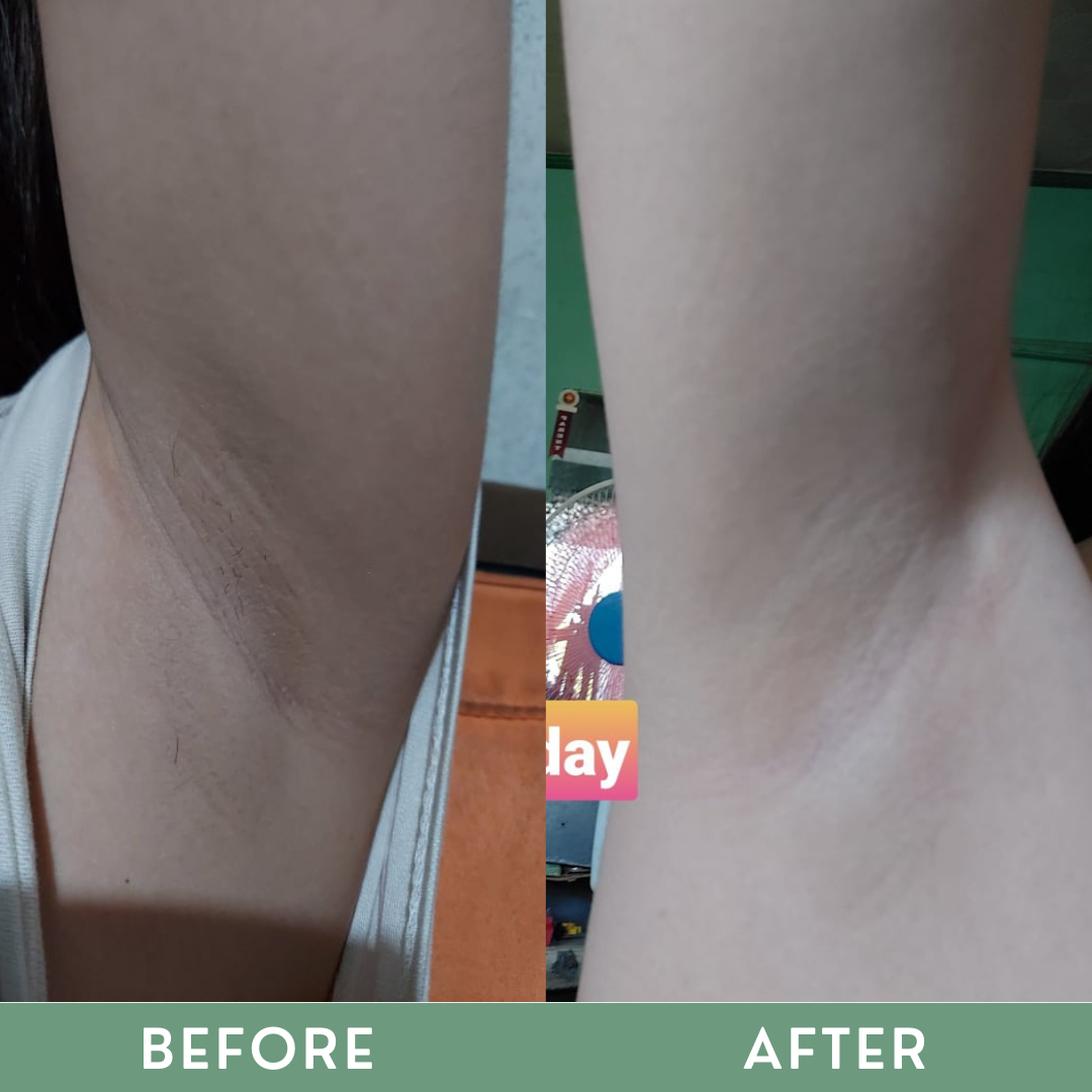 Greenika 10X Underarm Whitening Serum