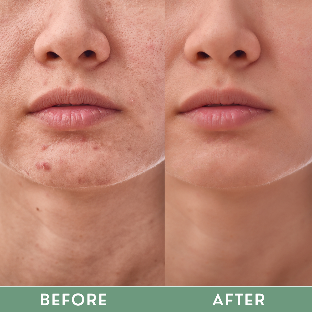 Greenika Pore Tightening Minimizer Oil Control Face Serum