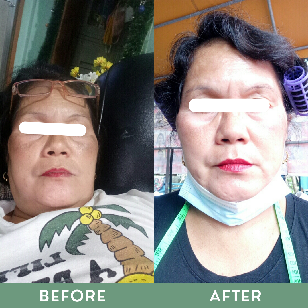 Greenika Retinol Cream