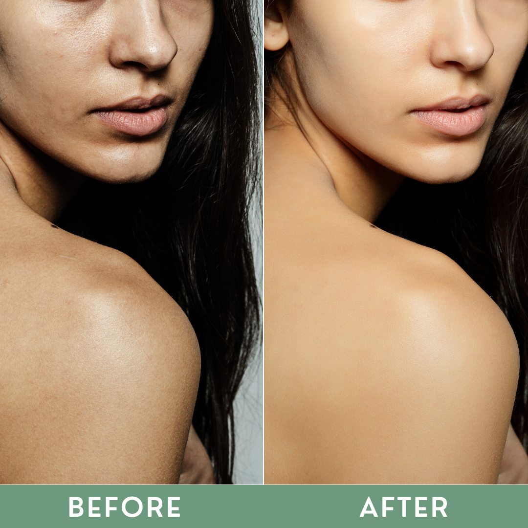 Greenika Premium MICRO PEELING Instant Skin Transforming Exfoliating Gel