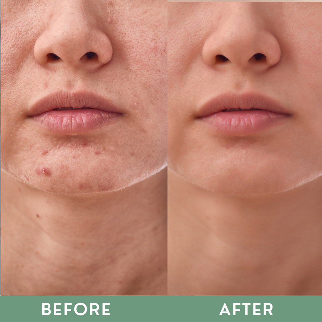 Greenika Cica Serum