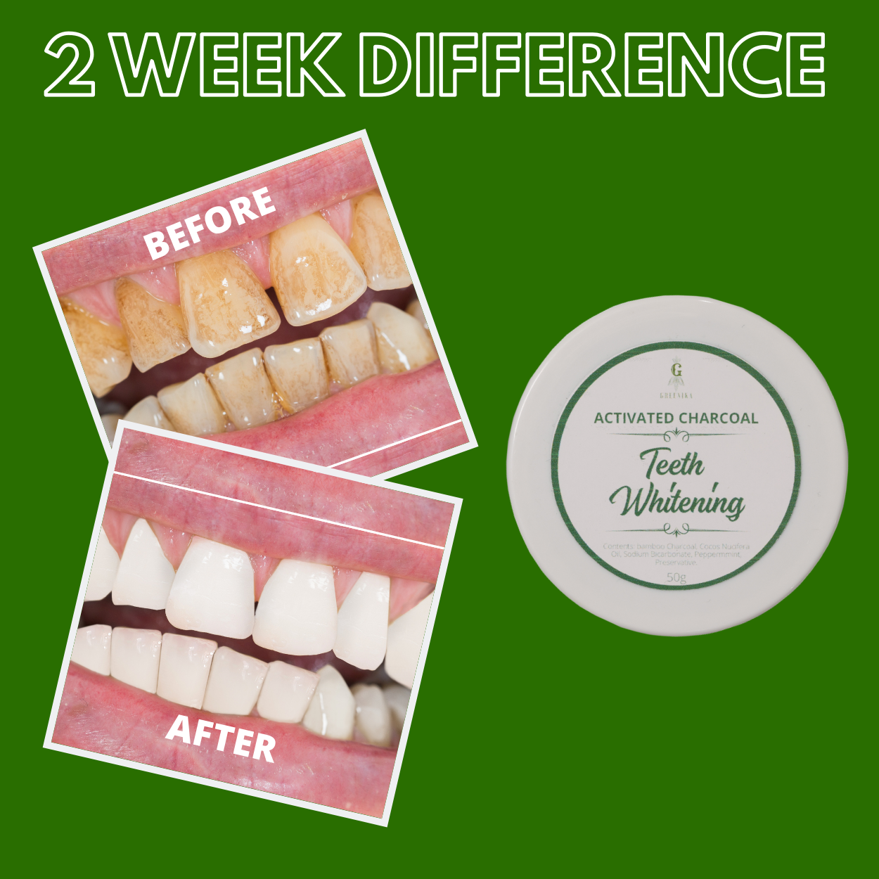Greenika Teeth Whitening Powder with Free Toothbrush