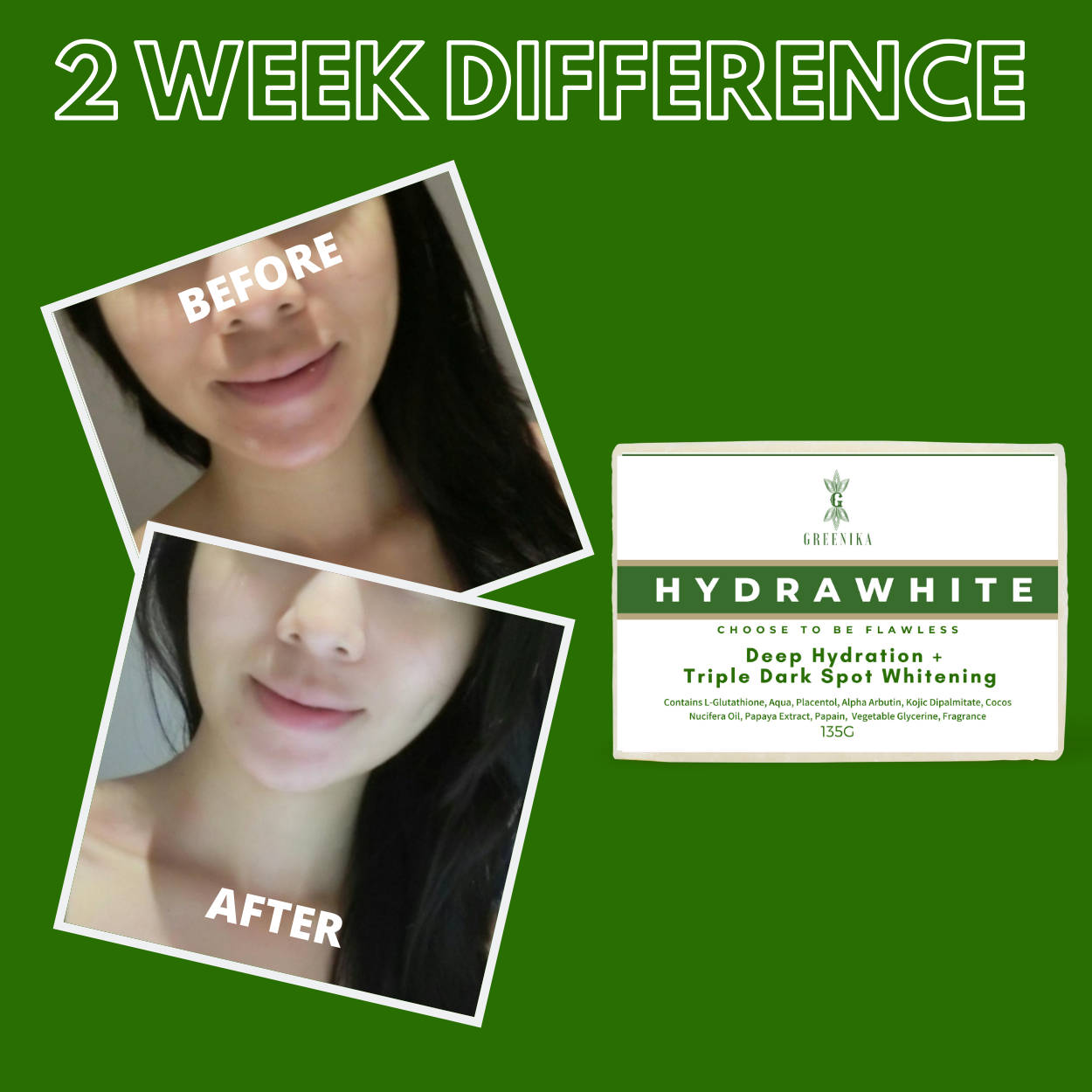 Greenika Hydrawhite Intense Moisturizer Soap