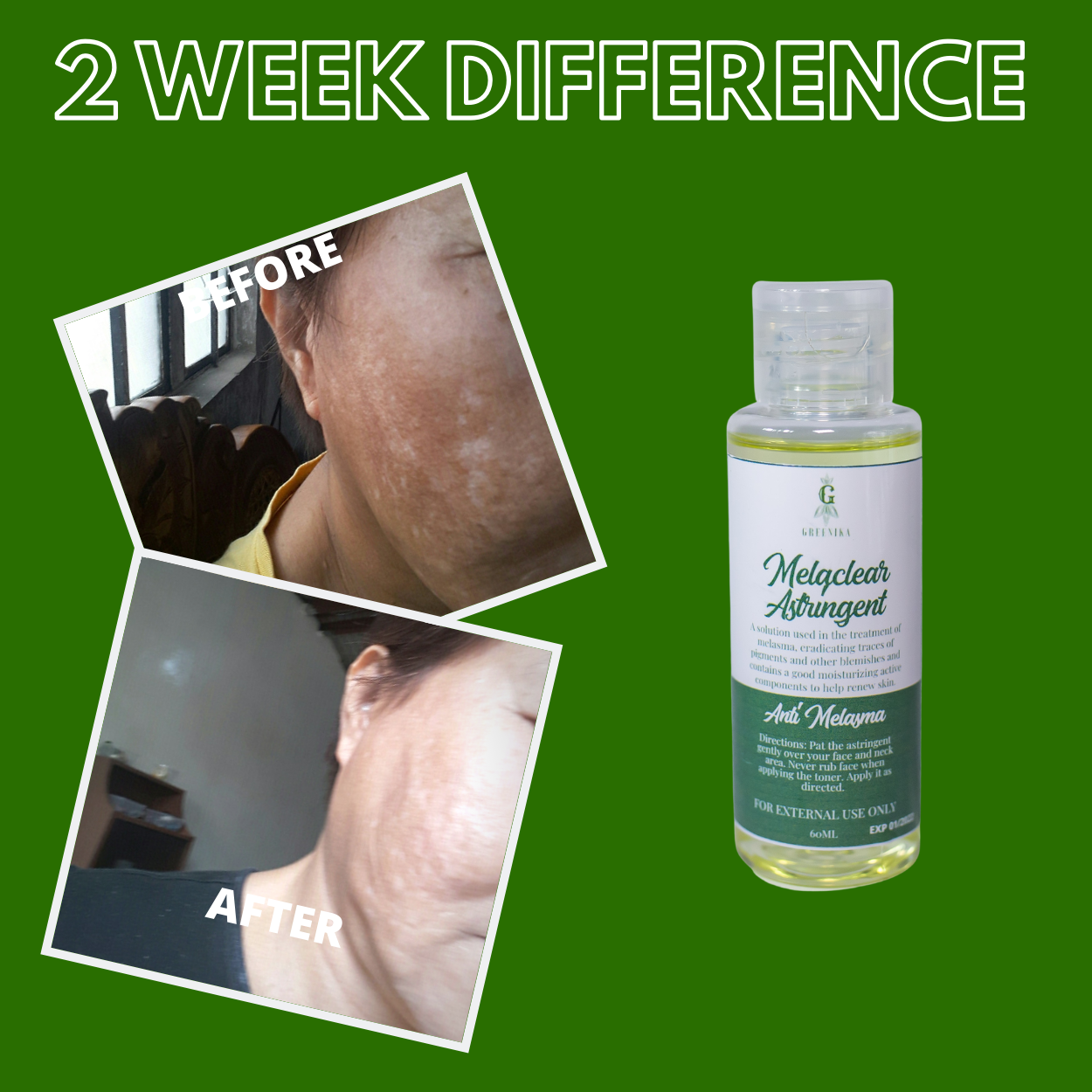Greenika Anti Melasma Melaclear Astringent Solution