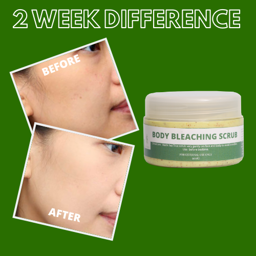 Greenika Body Bleaching Scrub for Body Whitening & Dark Spot Remover