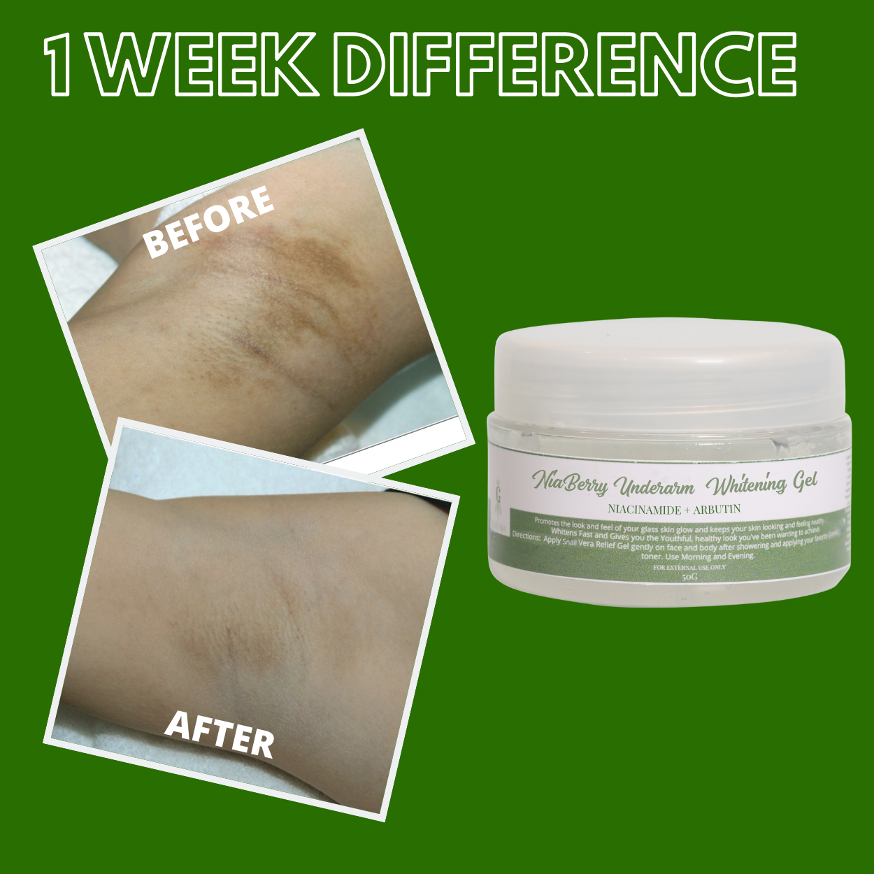 Greenika Niaberry Underarm Whitening Gel
