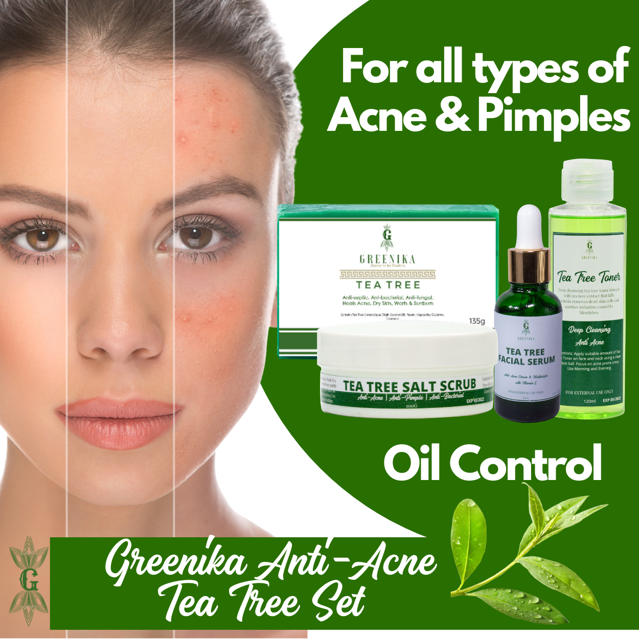 Greenika Tea Tree 4 Pc Anti Acne Set