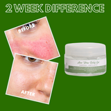 Greenika Aloe Vera Gel Whitening & Moisturizer for Face and Body