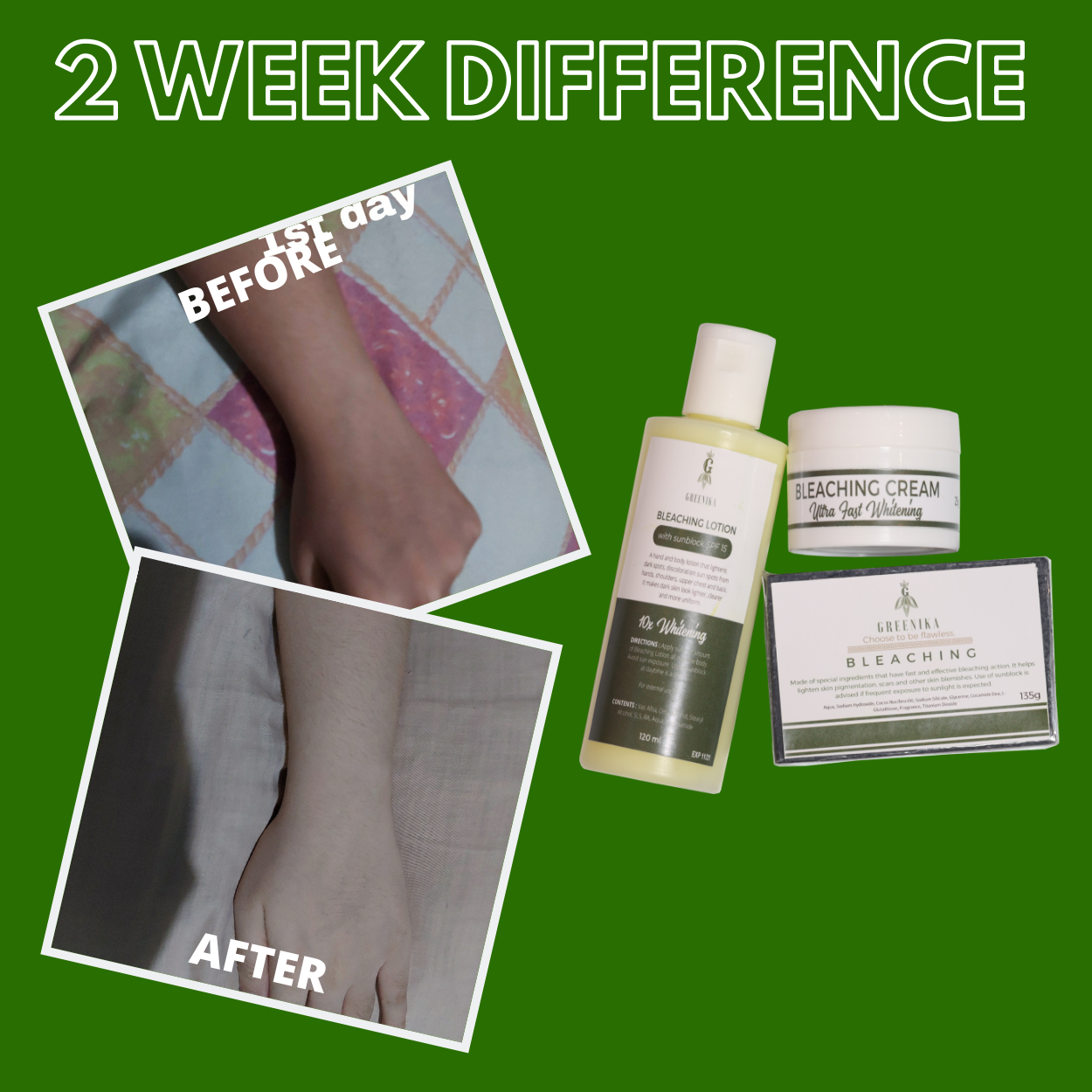 Greenika 3in1 Bleaching Set with Bleaching Soap, Bleaching Lotion and Bleaching Cream